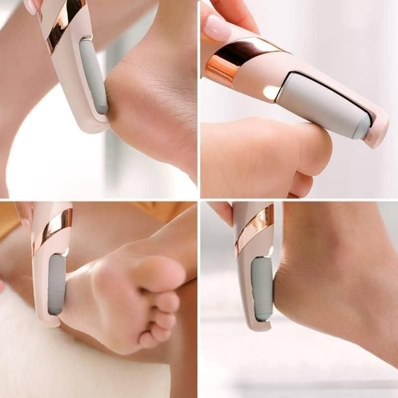 Cordless Pedicure Callus Remover – Dead Skin & Heel Cleaner